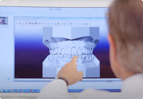 Orthodontics digital diagnostic